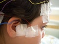 Girl with EEG electrodes attached to her head for medical test Royalty Free Stock Photo