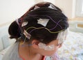 Girl with EEG electrodes attached to her head for medical test