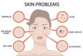 Girl Face with Skin problems, cosmetic care and beauty cosmetics medicine vector illustration