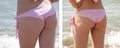 Girl figure in a swimsuit slimming cellulite he alth loss oversize before and after the diet fitness