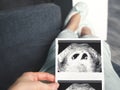 The girl is holding a snapshot of an ultrasound twin in the fourth week of pregnancy. First trimester. Selective focus