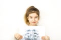 Girl holds her X-ray with a panorama of baby teeth and the second row of replaceable molars. Two rows of teeth, change to