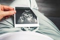 A girl holds a picture of an ultrasound baby in her twentieth week of pregnancy. Second trimester Selective focus Royalty Free Stock Photo