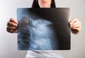 The girl holds an x-ray with outstretched arms showing a dislocation of the humerus and a fracture of the head of the