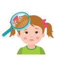 Girl with lice. Magnifying glass close up of a head. Vector illustration. Dirty head. Dirty hair. Infection.