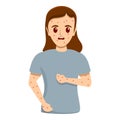 Girl measles infection icon, cartoon style