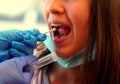 Girl with open mouth during oropharyngeal swab for coronavirus r Royalty Free Stock Photo