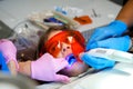 Girl in Orange Protective Glasses Gets Teeth Sealed Royalty Free Stock Photo