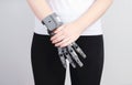 A girl with a prosthesis printed on a 3D printer folded her hands on her belt.