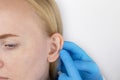 Darwin`s tubercle on the ear. The girl at the reception at the plastic surgeon, shows the auricle