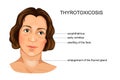 The girl`s face, suffering from hypothyroidism