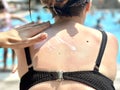 The girl\'s hands smear sunscreen on her back. Sunburn protection. Royalty Free Stock Photo