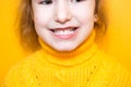 Girl shows her teeth-pathological bite, malocclusion, overbite. Pediatric dentistry and periodontics, bite correction. Health and