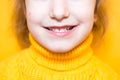 Girl shows her teeth-pathological bite, malocclusion, overbite. Pediatric dentistry and periodontics, bite correction. Health and