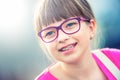 Girl. Teen. Pre teen. Girl with glasses. Girl with teeth braces. Young cute caucasian blond girl wearing teeth braces and glasses Royalty Free Stock Photo