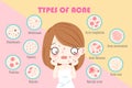 Girl with types of acne