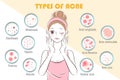 Girl with types of acne