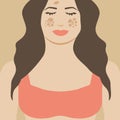 Girl or Woman with Melasma. Pigmentation Spots Illustration Design Royalty Free Stock Photo