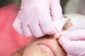 Girl's face during a cosmetic procedure. Cleansing the skin of comedones.