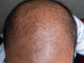 Glabrous on Male Bald head .