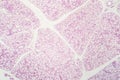 Glandular epithelium, micrograph