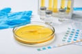 Glass dish with urine on table. Urology concept Royalty Free Stock Photo