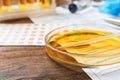 Glass dish with urine on table. Urology concept