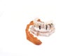 Glass jaw model with implanted Royalty Free Stock Photo