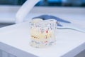 Glass jaw model with implanted dentures on the working dental table surface Royalty Free Stock Photo