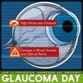 Glaucoma Day Design: Sick Eye Scan Due to this Disease, Vector Illustration