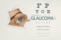 Glaucoma disease poster with eye test and blue eye on right Royalty Free Stock Photo