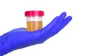 A gloved doctor hand with the urine container for medical urine test. A photo of urine specimen, medical analysis in the laborator Royalty Free Stock Photo