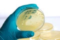 Yellow bacteria on a petri dish in the hand of a scientist on the laboratory background Royalty Free Stock Photo
