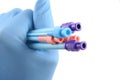 Gloved hand holding surgical introducers