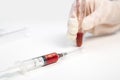 The gloved hand of a laboratory assistant holds a test tube with a blood sample on a white background. also in the photo is a