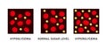 Glucose Blood Sugar Level Set. Hypoglycemia and Hyperglycemia Icons. Vector