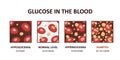 Glucose levels in the blood diagram