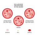 Glucose levels infographic. Vessel and blood health. Vector