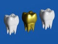 Golden tooth next to white teeth, gold crown tooth. 3d illustration