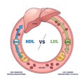 Good HDL and bad LDL cholesterol movement comparison outline diagram Royalty Free Stock Photo