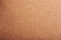 Goose bumps on human skin