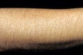 Goosebumps on Caucasian female skin Royalty Free Stock Photo