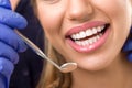 Gorgeous healthy smile with dentist mirror