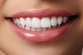 Gorgeous Young Mom with a Charming Smile and Perfect Teeth, Close-Up at Orthodontic Clinic