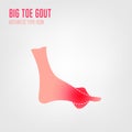 Gout arthritis icon