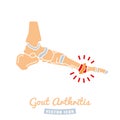 Gout arthritis icon