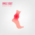 Gout arthritis icon