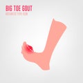 Gout arthritis icon