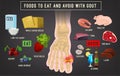 Gout arthritis infographic Royalty Free Stock Photo