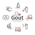 Gout banner. Symptoms, Treatment. Vector signs for web graphics.